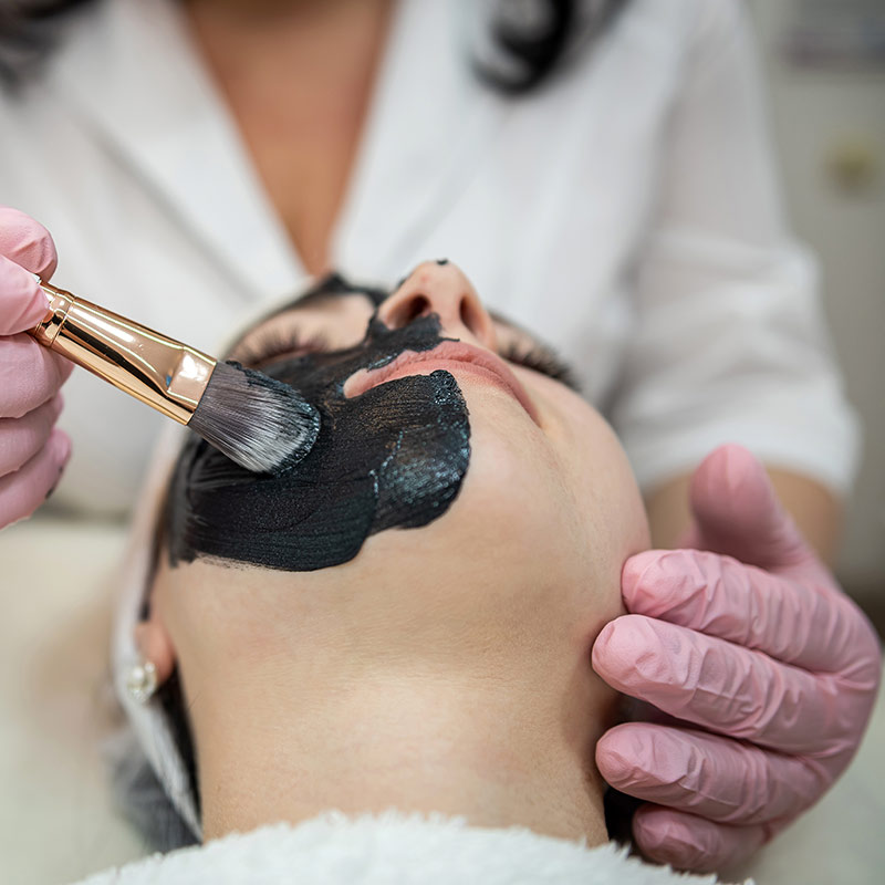 tecnologie-per-peeling-viso-trattamenti-hollywood-carbon-peel