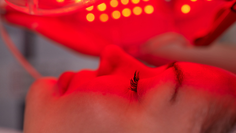 terapia-fotodinamica-bioskin