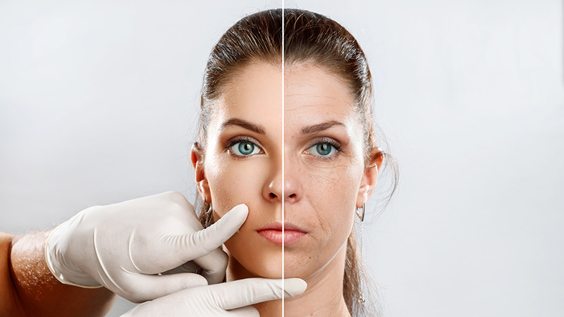 trattamento-delle-rughe-bioskin