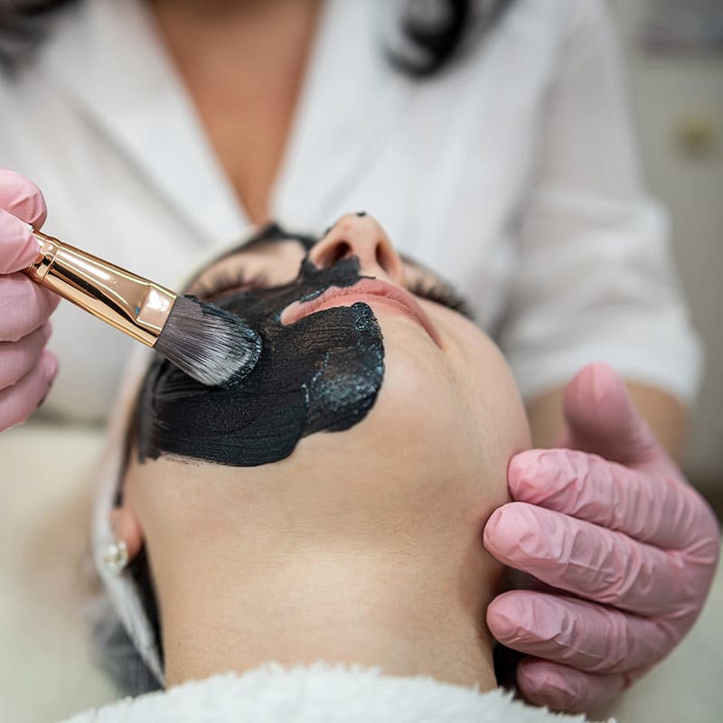 devices-and-technologies-for-hollywood-carbon-peel-treatments