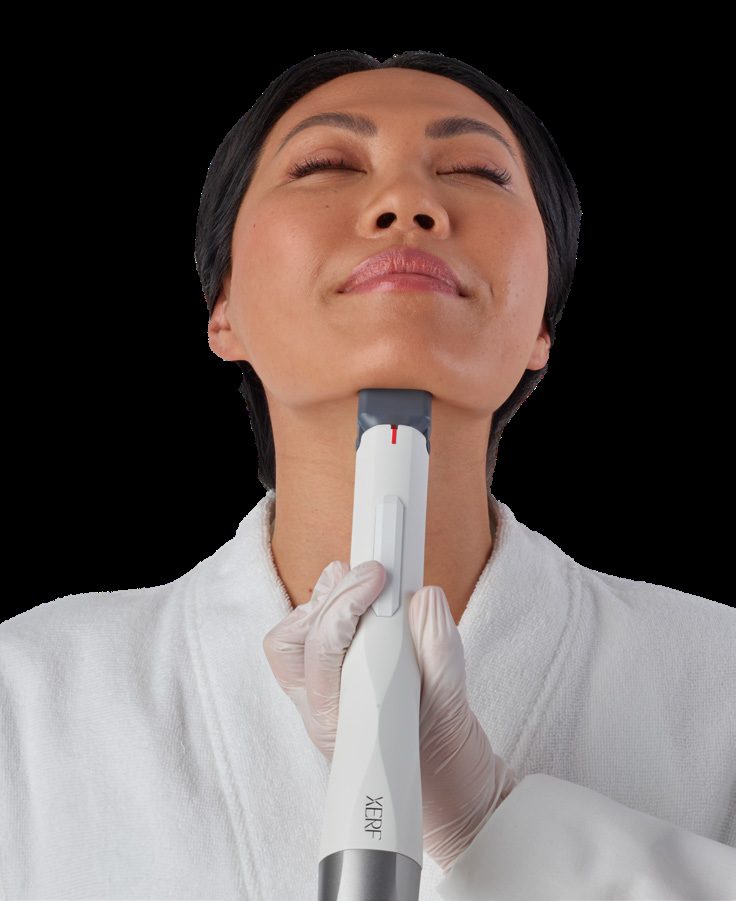 xerf-trattamento-skin-tightening